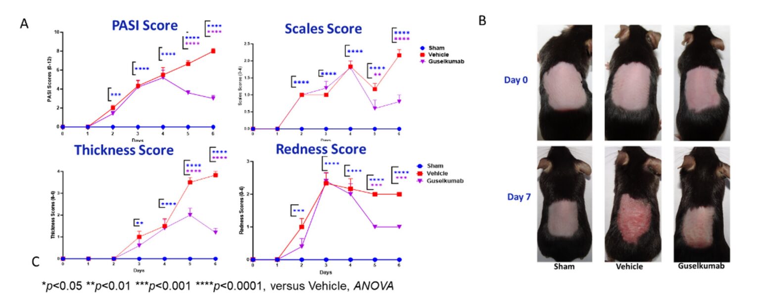 psoriasis: pathogenesis, treatment, and evolving disease models 9 Figure 7 Psoriasis Blog
