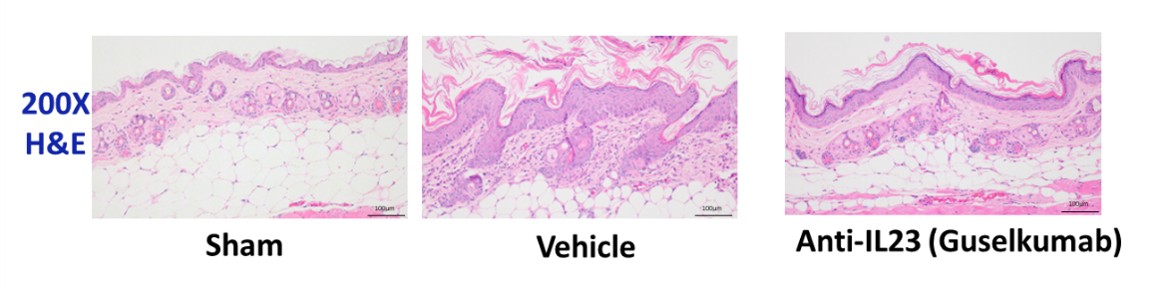 psoriasis: pathogenesis, treatment, and evolving disease models 10 Figure 8 Psoriasis