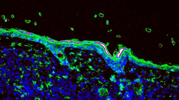 the crucial role of biomarkers in the precision medicine revolution 2 Beyond Single Marker Pathology Blog Image 1